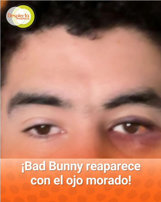  Bad Bunny por imagen con ojo morado